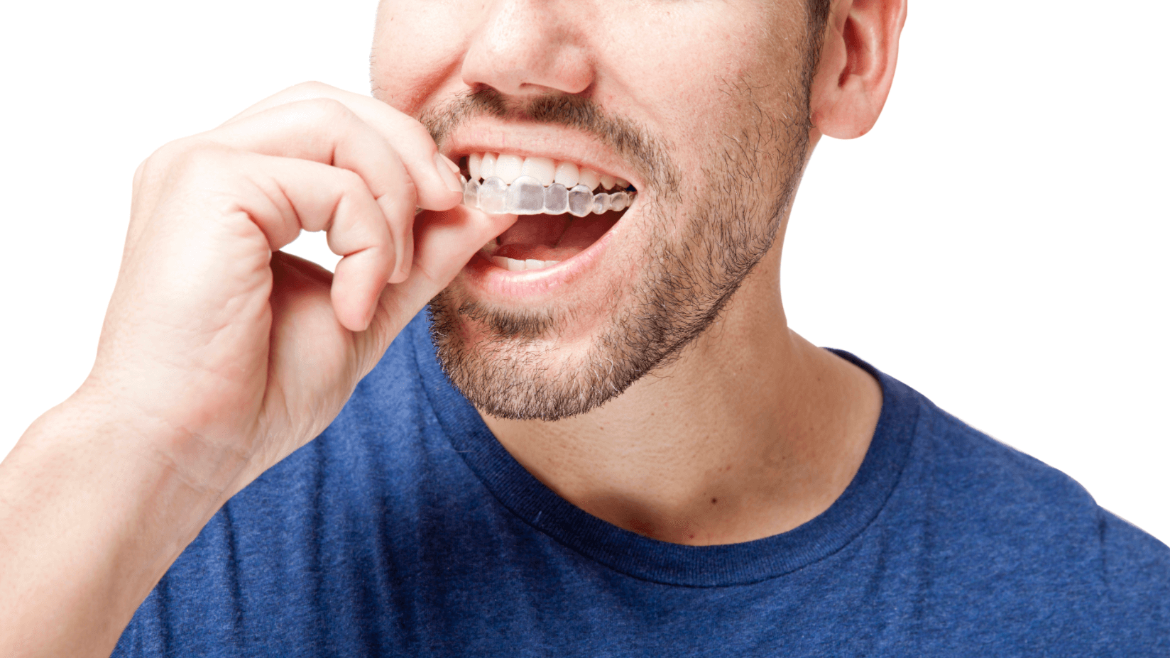 How Do You Keep Your Teeth Straight After Orthodontics? - Midtown Dental  Group