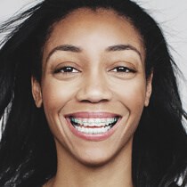 Traditional Metal Braces