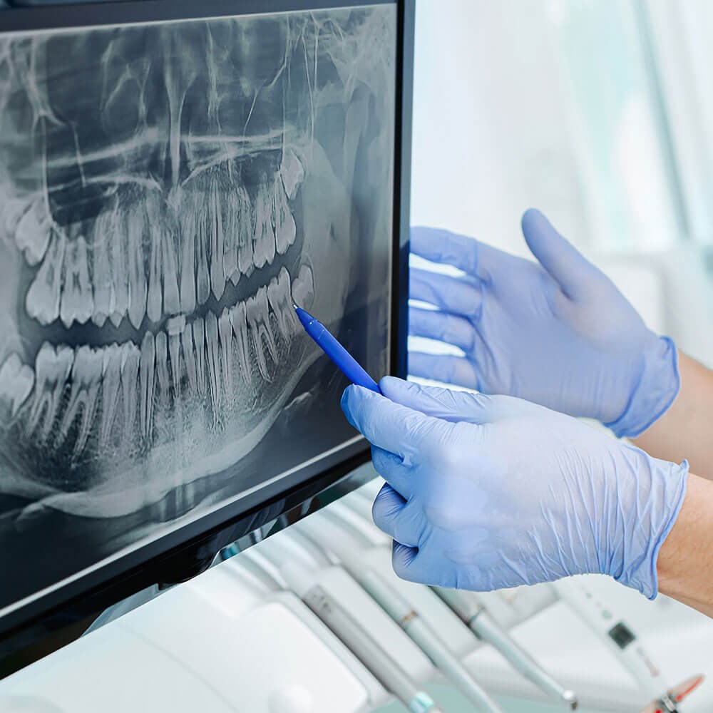 Dental Radiology