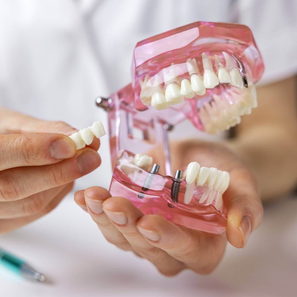 Implant Dentistry