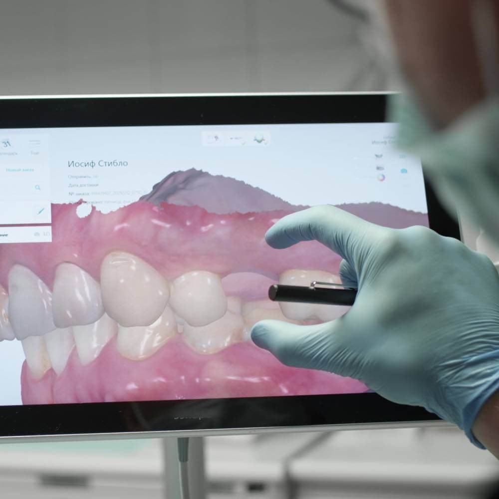 Implant Planning
