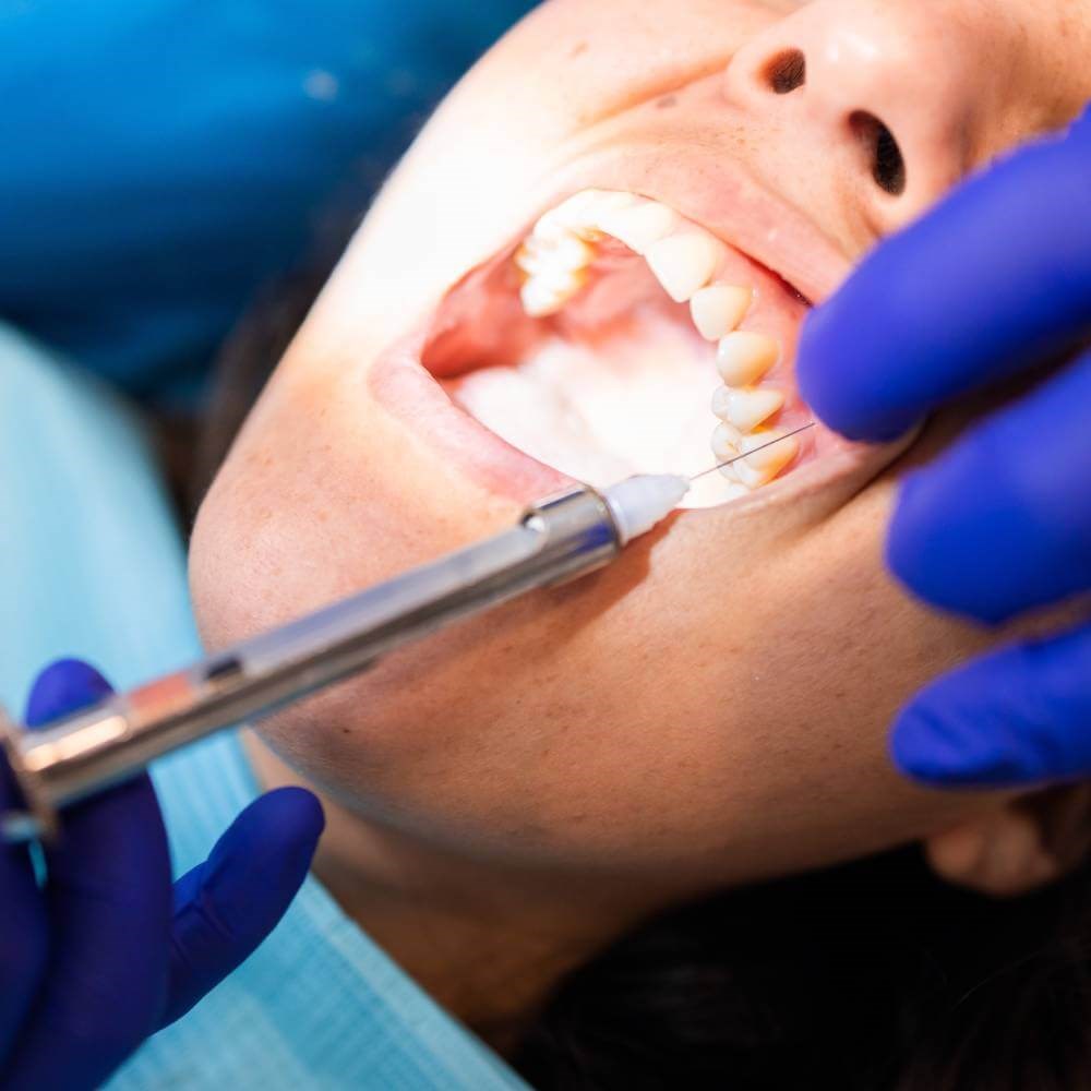 Local Anesthesia